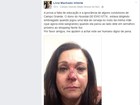 Motorista ataca lata de cerveja no rosto de professora universitária