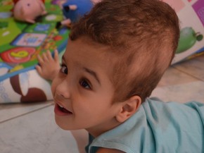 mae conta como aprendeu a lidar com o filho que tem hidrocefalia acre g1