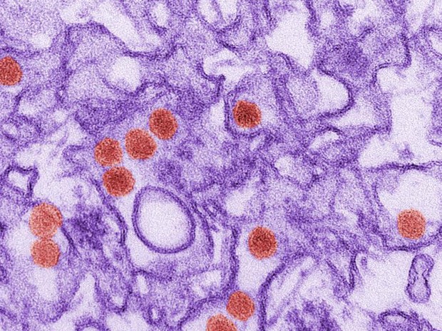 Imagem de micrografia eletrônica de transmissão colorida digitalmente mostra o vírus da zika; na imagem colorida digitalmente, o vírus é representado pelos pontos vermelhos (Foto: CDC/Cynthia Goldsmith)