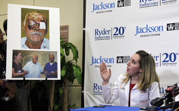 A cirurgiã plástica Wrood Kassira, do Jackson Memorial Hospital, exibe imagens de Ronald Poppo, que teve rosto devorado por ataque canibal, durante entrevista nesta terça (12) (Foto: Wilfredo Lee / AP)