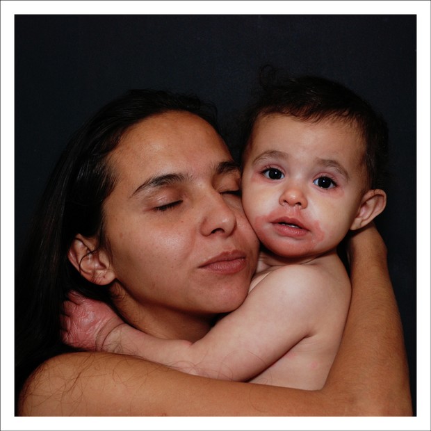 Taísa com sua filha Isabella aos dois anos. A menina recebeu um presente de Natal antecipado (Foto: (Foto: Régia Patriota/ Exposição Além da Pele)) Taísa com sua filha Isabella aos dois anos. A menina recebeu um presente de Natal antecipado (Foto: (Foto: Régia Patriota/ Exposição Além da Pele))