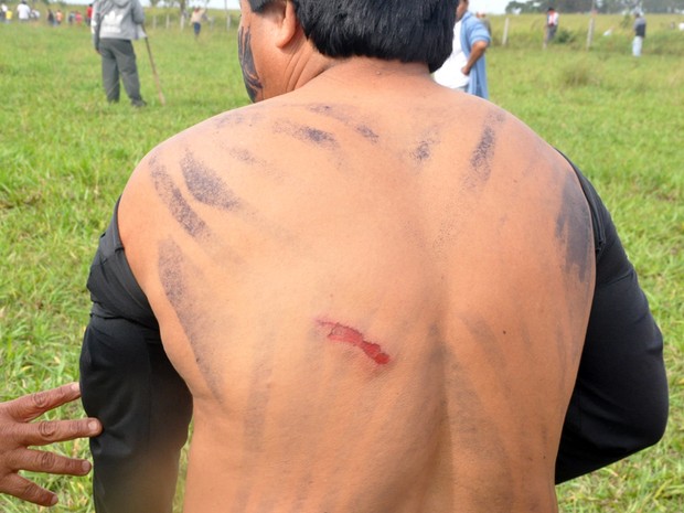 Cacique mostra ferimento nas costas após confronto com policiais (Foto: Tatiane Queiroz/G1 MS)