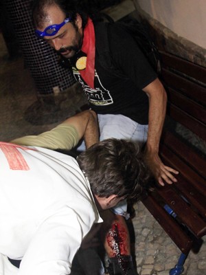Rafael Caruso, atingido na perna, foi atendido por um médico voluntário antes de ser levado para o Souza Aguiar (Foto: Diego Assis / Agência O Dia / Estadão Conteúdo)