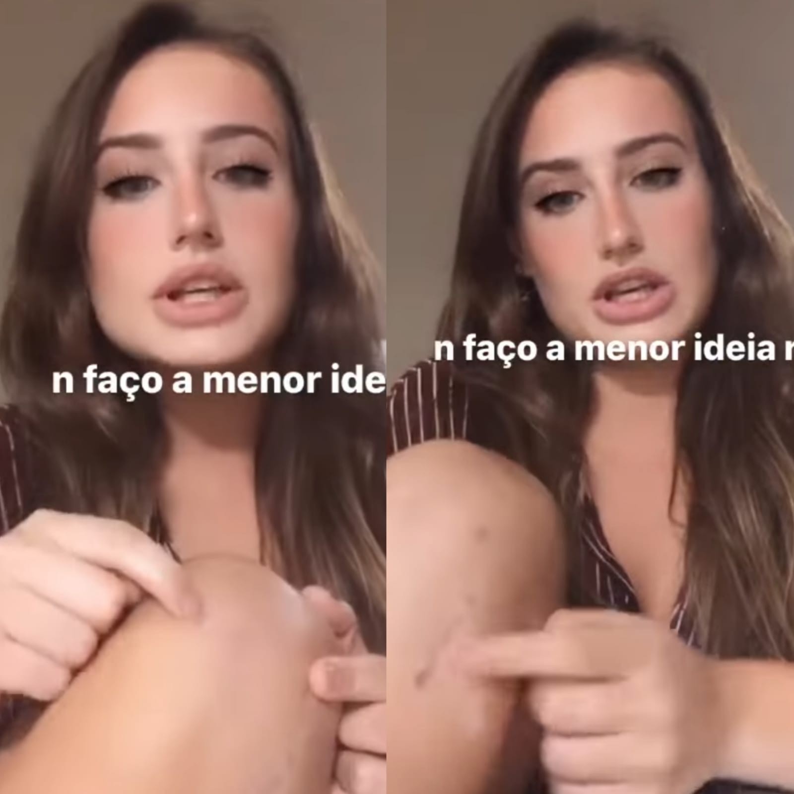 Bruna Griphao fala sobre cirurgia (Foto: Reprodução/Instagram) Bruna Griphao fala sobre cirurgia (Foto: Reprodução/Instagram)