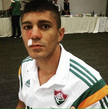Edson machucado Fluminense (Foto: Reprodução / Instagram) Edson machucado Fluminense (Foto: Reprodução / Instagram)