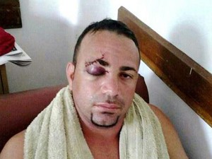 Homem foi agredido por extintor no Extra (Foto: José Evaldo/Arquivo Pessoal)