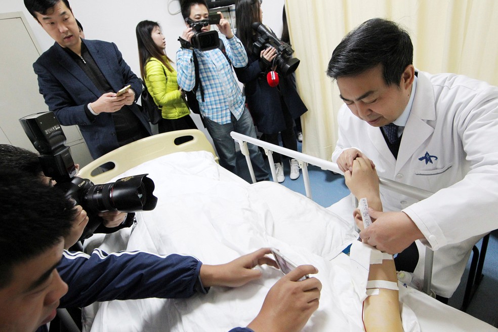 M&eacute;dico mostra orelha artificial implantada em bra&ccedil;o de paciente na China (Foto: China Daily/via Reuters)