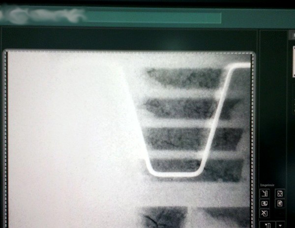 Folha de raio-x utilizada no teste realizado pelos técnicos acusou vazamento de radiação (Foto: Divulgação/Sindsaúde RN)