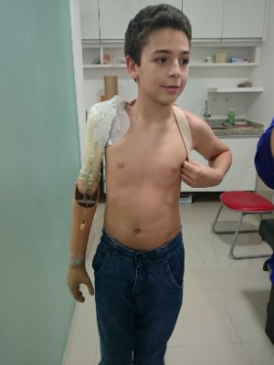 Menino provou prótese pela primeira vez em Sorocaba (Foto: Ana Carolina Levorato/G1)