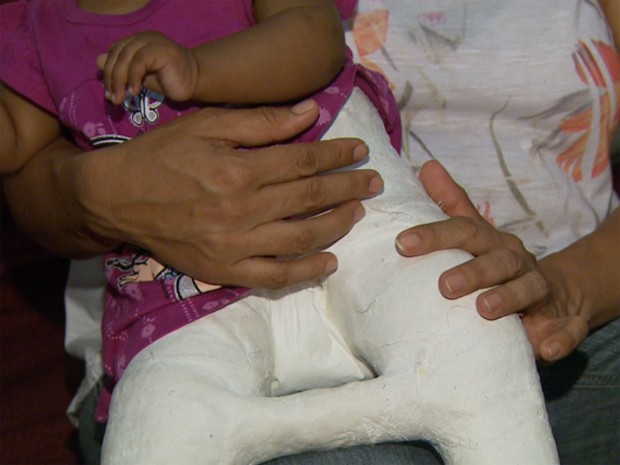 Mãe quer ir à Justiça após 'santinhos' causarem lesão em filha de 6 meses (Foto: Reprodução / EPTV)