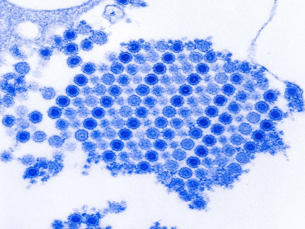 Vírus chikungunya (Foto: CDC/PHANIE)