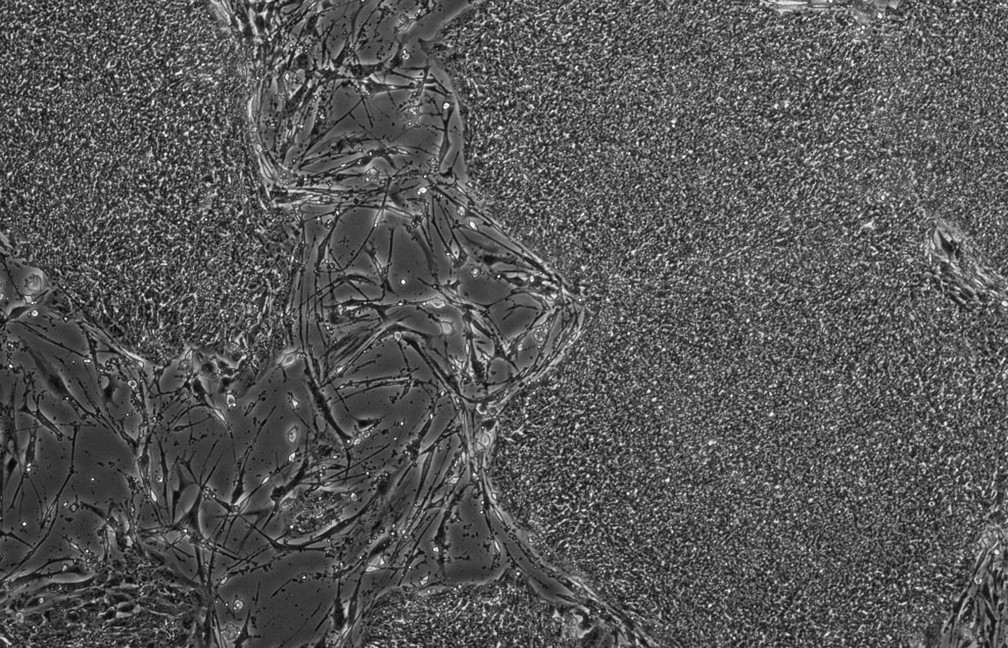 Imagem de células-tronco pluripotentes crescendo, também em estudo de George Daley e Ryohichi Sugimura (Foto: Rio Sugimura)