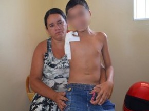 José Diemerson sofreu uma fratura no braço após cair de um cavalo (Foto: Tacyane Machado)