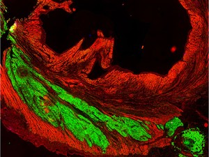 Imagem mostra enxerto de células cardíacas derivadas das células-tronco humanas (em verde) entrelaçadas com as células cardíacas do primata (em vermelho)  (Foto: Murry Lab/Universidade de Washington/Divulgação)