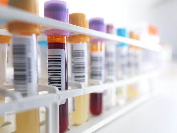 Descoberta pode levar a exame de sangue para detectar Alzheimer  (Foto: Science Photo Library)