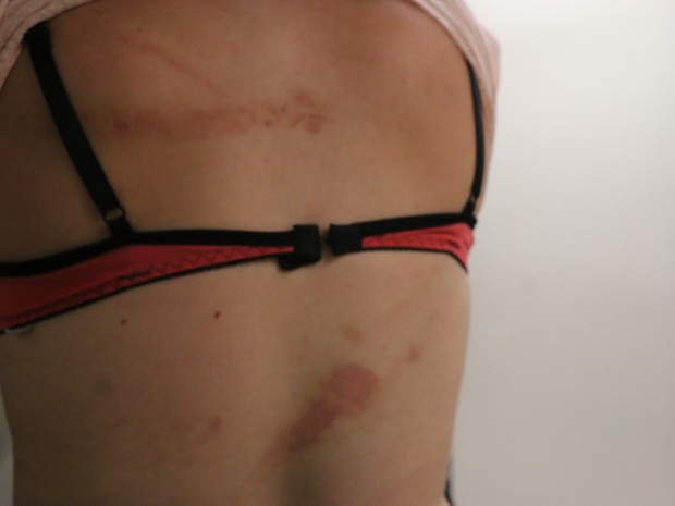 Mulher exibe marcas da violência em visita ao Juizado especializado (Foto: Joyce Heurich/G1)