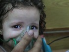 Imagens exclusivas indicam ataque com bomba de cloro em meio ao cerco a Aleppo