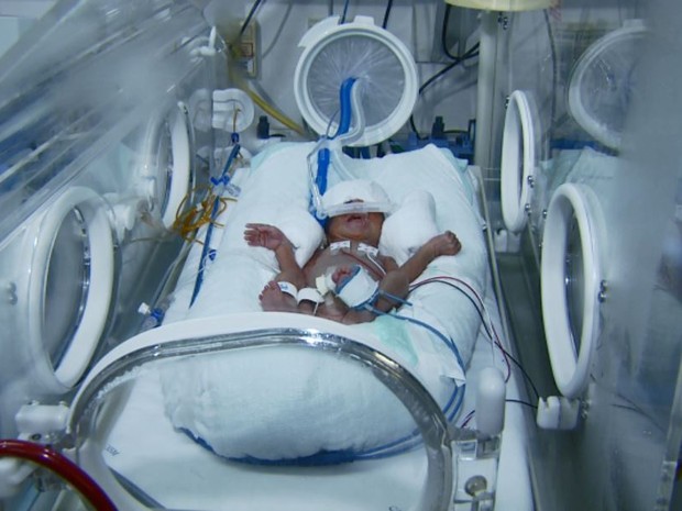 Bebê prematuro está na UTI neonatal do Caism, em Campinas (Foto: Reprodução/EPTV)