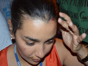 Fotojornalista foi atingida por uma pedra enquanto cobria a manifestação nesta terça-feira (25) (Foto: Flávio Antunes/G1)