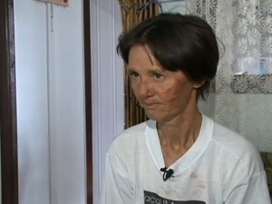 Segundo a cuidadora, membros da família das irmãs lhe agrediram, como um ato vingança  (Foto: Reprodução/RBS TV)
