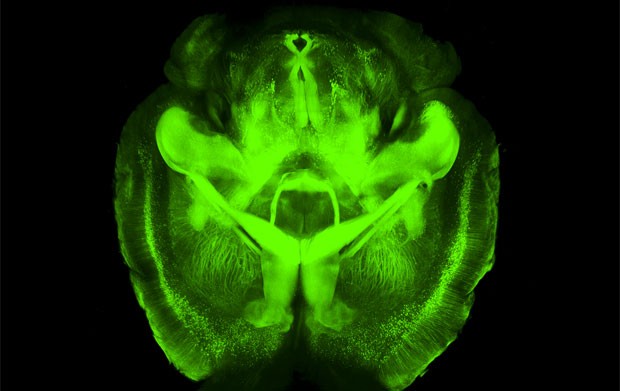 A técnica desenvolvida por cientistas permite enxergar através do cérebro sem que o órgão seja cortado  (Foto: Kwanghun Chung e Karl Deisseroth/Howard Hughes Medical Institute/Universidade Stanford)