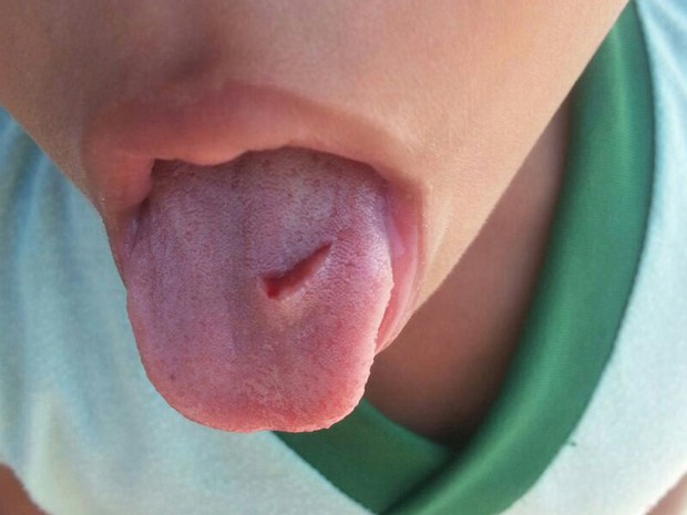 Segundo mãe, professora cortou garoto após ele mostrar a língua (Foto: Joátila Bispo/ Arquivo Pessoal)