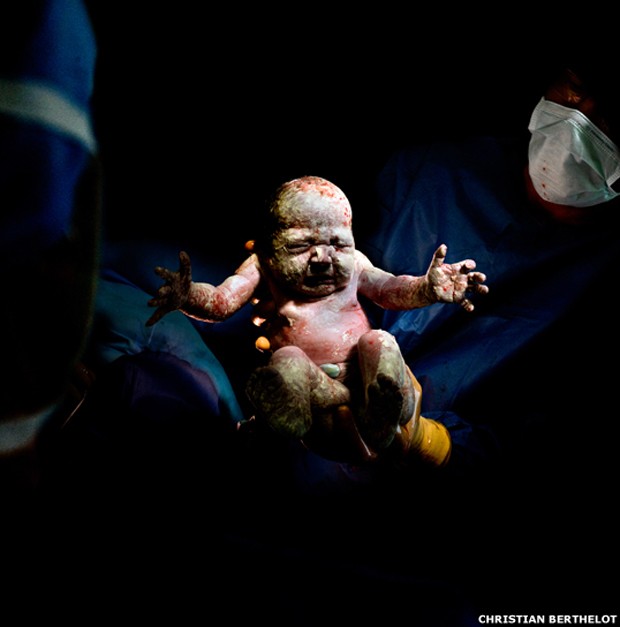 Romane, dia 20 de maio de 2014, às 10h51, peso: 2,935 quilos, oito segundos depois do nascimento (Foto: Christian Berthelot) Romane, dia 20 de maio de 2014, às 10h51, peso: 2,935 quilos, oito segundos depois do nascimento (Foto: Christian Berthelot)