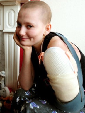 sarcoma cancer raro