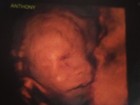Simony divulga ultrassonografia de Anthony, seu quarto filho