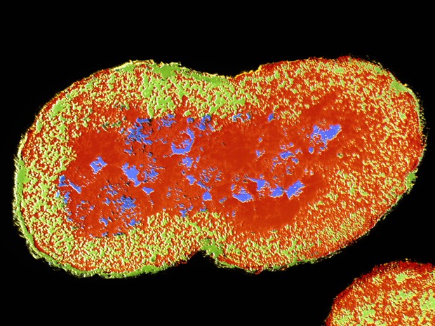 Bactéria 'Neisseria gonorrhoeae'  tem forma de rim e muitas vezes ocorre em pares (Foto: MAH/Science Photo Library/Arquivo AFP)