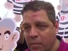 Deputado do PSDB é agredido durante protesto contra Lula no AC 