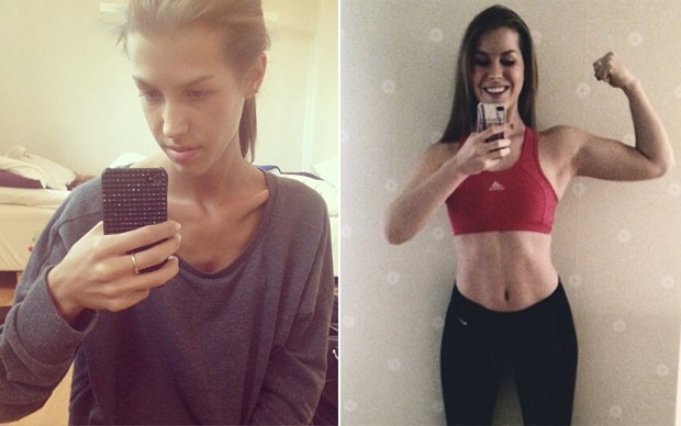 Fotos antes e depois do tratamento mostra a evolução de Antonia Eriksson na luta contra a anorexia (Foto: Reprodução/Instagram)