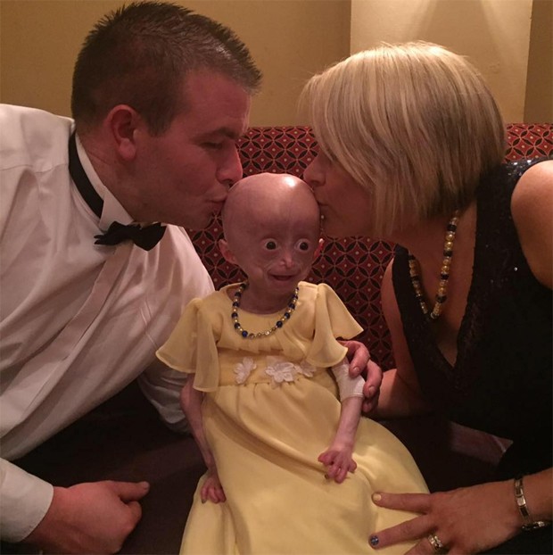 Lucy Parke (em foto com os pais) sofria da Síndrome de Hutchinson Gilford Progeria (Foto: Reprodução)