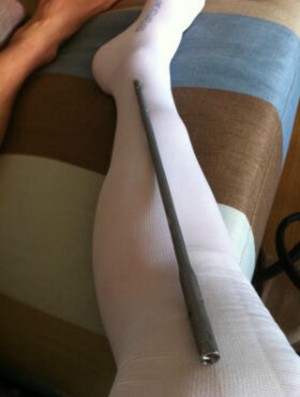 Mark Webber publica foto da perna engessada no twitter (Foto: Reprodução/Twitter)