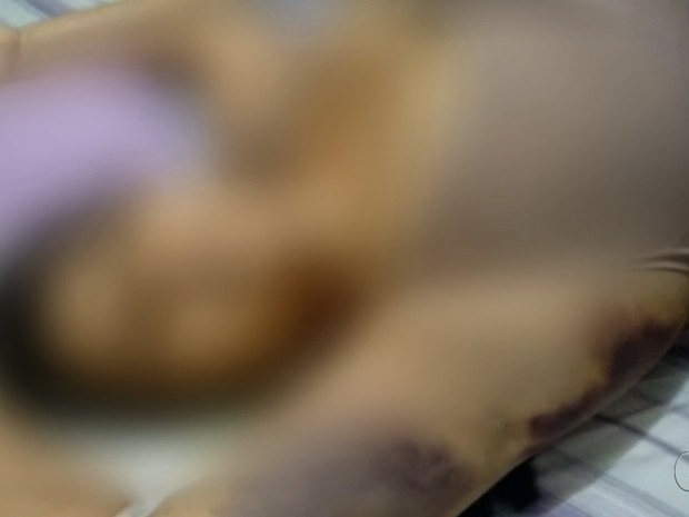 Áudio revela queixa de mulher que morreu após lipo: &#39;Vomitei 20 vezes&#39; em Goiás (Foto: Reprodução/TV Anhanguera)