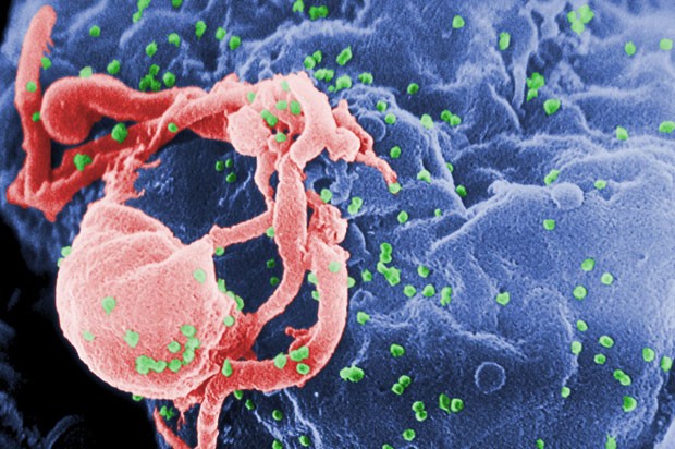  Imagem de microscópio eletrônico mostra vírus HIV em superfície de célula  (Foto: Cynthia Goldsmith/Centers for Disease Control and Prevention via AP)