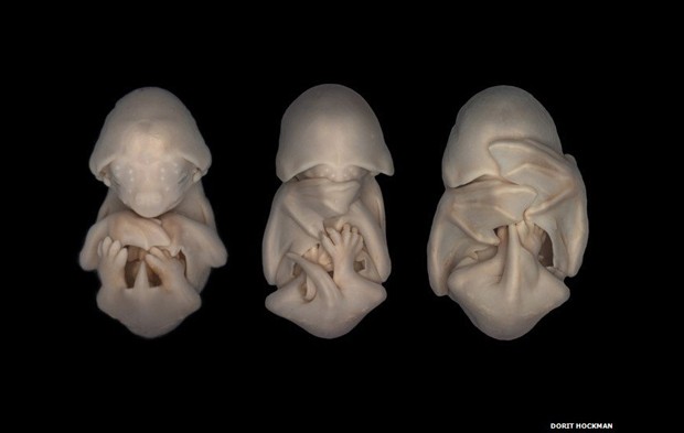A maior parte das imagens foram feitas por cientistas durante suas pesquisas. Dorit Hockman, da Universidade de Cambridge, retratou estes embriões de morcegos. (Foto: Bat embryonic development, 2006, by Dorit Hockman, University of Cambridge)