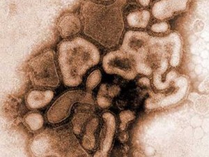 O vírus H1N1, que causou uma pandemia de gripe (Foto: reprodução)
