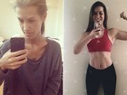 Jovem cria diário no Instagram para mostrar batalha contra a anorexia