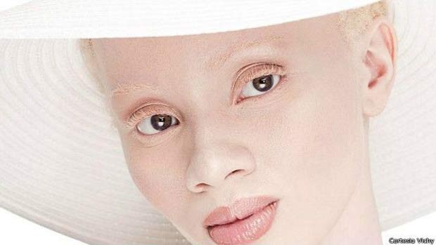 Antes de tornar-se modelo, Thando Hopa estudou direito e tornou-se advogada (Foto: Cortesia/Vichy)