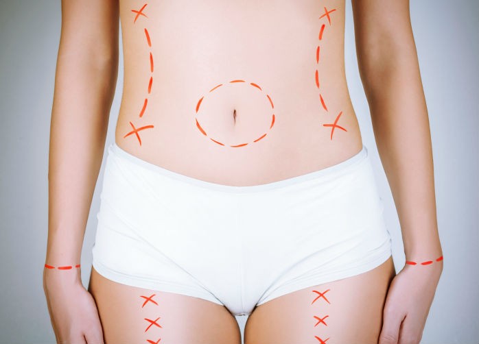 Cirurgia plstica (Foto: Getty Images) Cirurgia plstica (Foto: Getty Images)