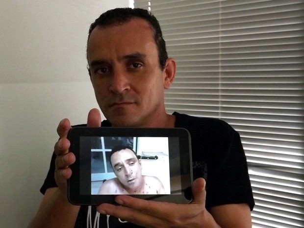 Antônio Carlos disse que foi um milagre ter sobrevivido (Foto: Alan Schneider/G1)