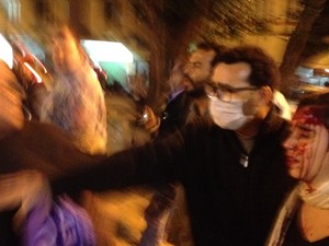 Mulher é ferida por bala de borracha durante protesto no Rio (Foto: Henrique Coelho/G1)
