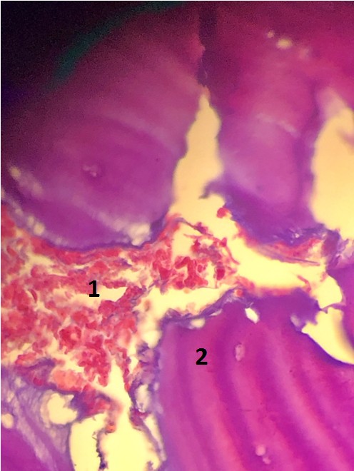 (1) Hemácias dentro do vaso sanguíneo; e (2) Trabeculado ósseo do corpo da mandíbula (Foto: Eder Huttner, Bruno Candeias, Edison Huttner.)