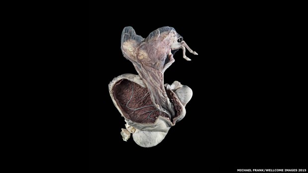 Imagem mostra útero de uma égua cujo feto foi removido, mas que ainda contém as membranas fetais e o cordão umbilical (Foto: Michael Frank/Wellcome Images 2015)