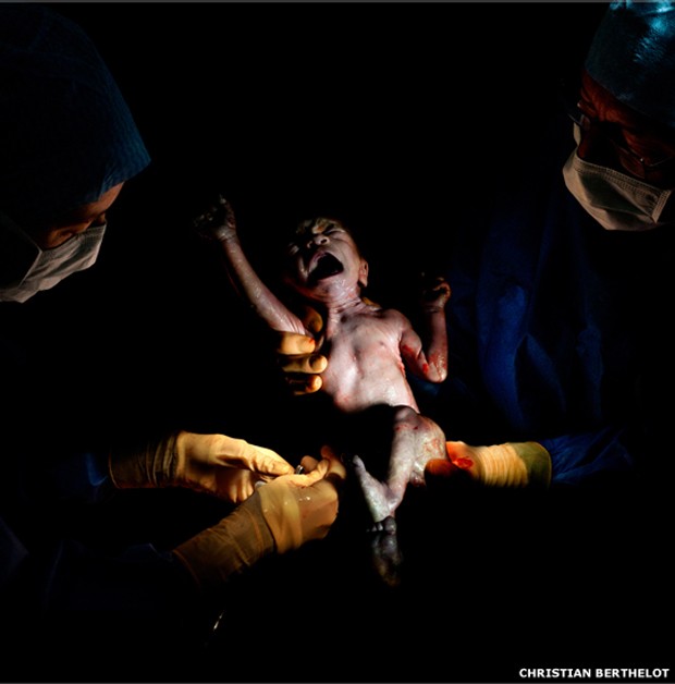 Steven, nascido em 21 de dezembro de 2013, 16h31, peso: 2,425 quilos, 15 segundos depois do nascimento (Foto: Christian Berthelot) Steven, nascido em 21 de dezembro de 2013, 16h31, peso: 2,425 quilos, 15 segundos depois do nascimento (Foto: Christian Berthelot)