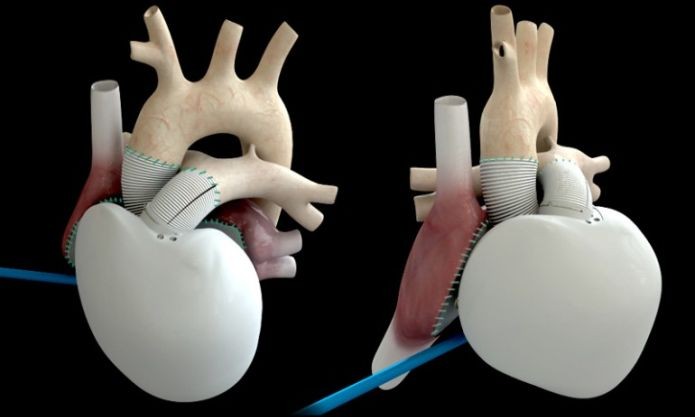 Você teria um coração totalmente artifical? (Foto: Divulgação/Carmat)