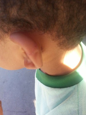 Criança também foi ferida na orelha, diz mãe (Foto: Joátila Bispo/ Arquivo Pessoal)