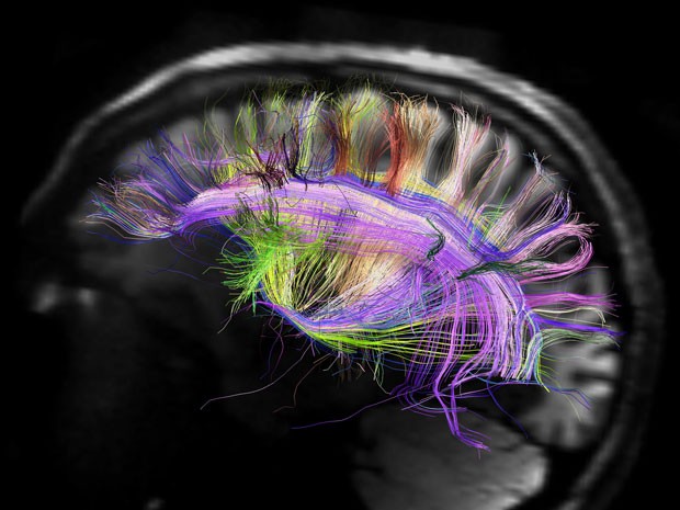 Cérebro visto como uma grade curvada, em imagem feira por estudo publicado nesta quinta (29) (Foto: MCH-UCLA Human Connectome Project)