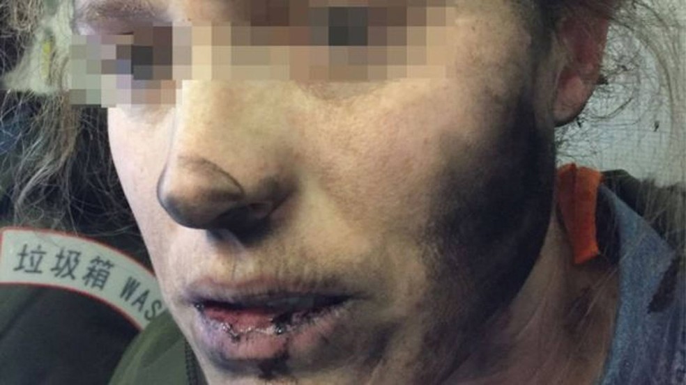 A passageira estava ouvindo música quando aparelho explodiu  (Foto: Australian Transport Safety Bureau )